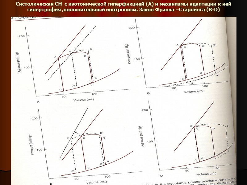 Систолическая СН  с изотонической гиперфнкцией (А) и механизмы адаптации к ней гипертрофия ,положительный